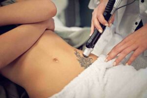 Read more about the article Best Permanent Tattoo Removal Approach in 2023: Here is everything you need to know