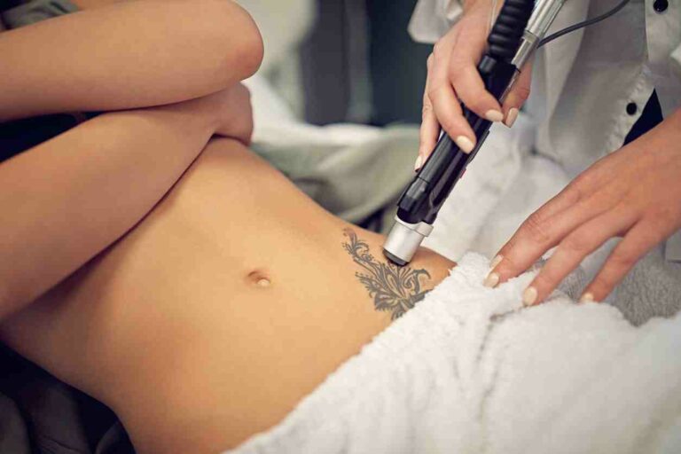 Best Permanent Tattoo Removal Approach in 2022: Here is everything you need to know